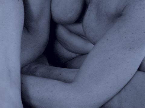 difformité 05